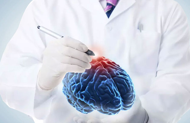 Brain Neurology